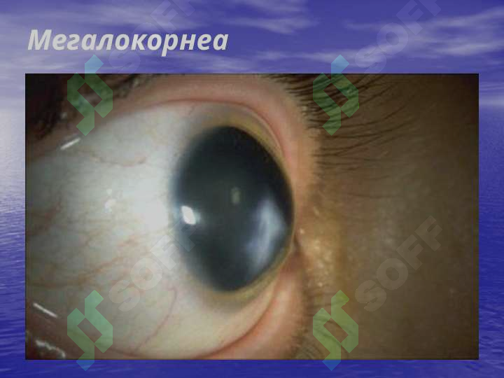 Preview 5
