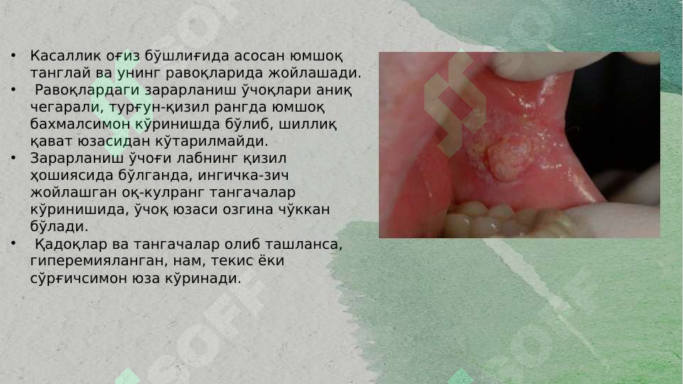 Product slide 6