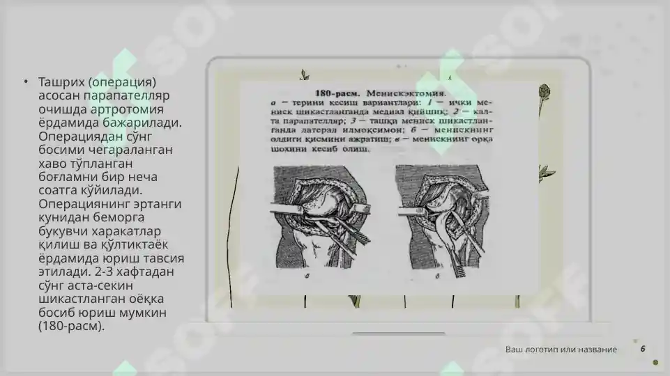Product slide 6