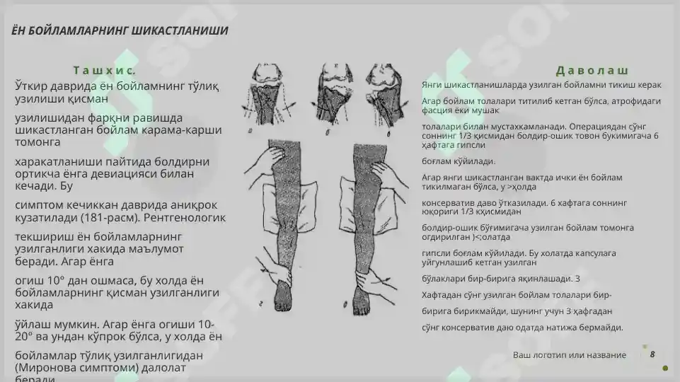 Product slide 8